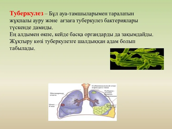 Туберкулез – Бұл ауа-тамшыларымен таралатын жұқпалы ауру және aғзағa туберкулез бактериялары