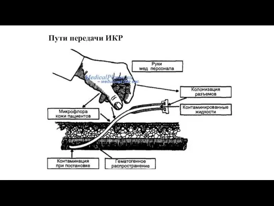 Пути передачи ИКР