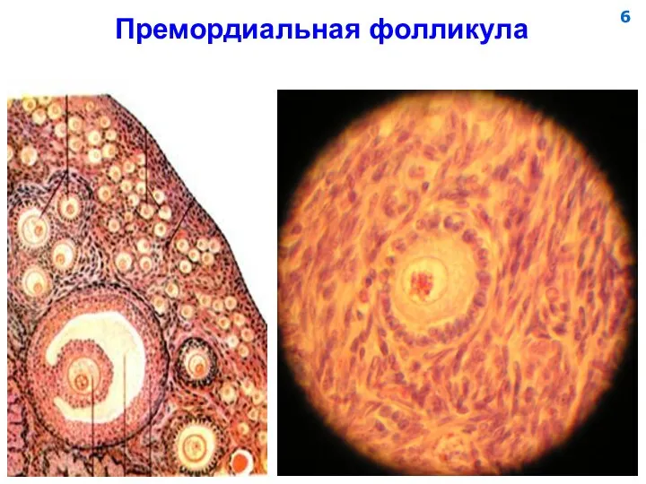 Премордиальная фолликула 6