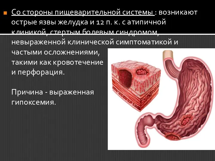 Со стороны пищеварительной системы : возникают острые язвы желудка и 12