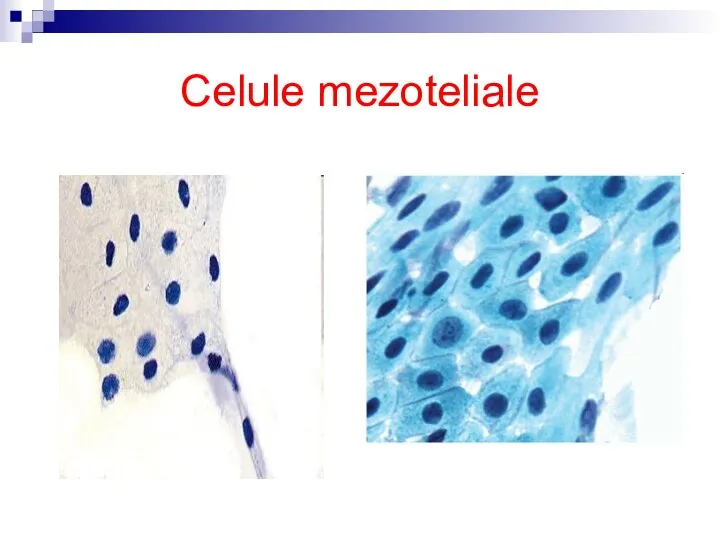 Celule mezoteliale