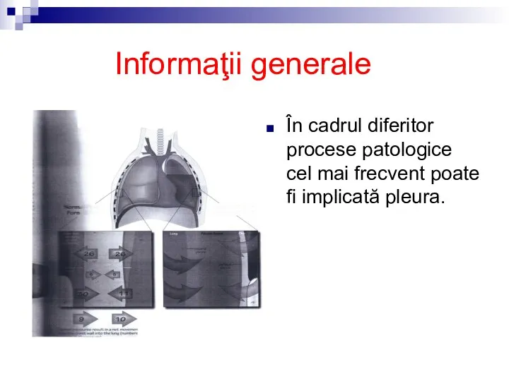 Informaţii generale În cadrul diferitor procese patologice cel mai frecvent poate fi implicată pleura.