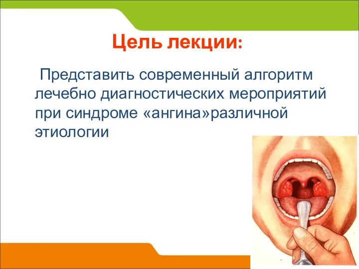 Цель лекции: Представить современный алгоритм лечебно диагностических мероприятий при синдроме «ангина»различной этиологии
