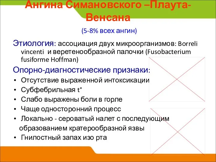 Ангина Симановского –Плаута-Венсана (5-8% всех ангин) Этиология: ассоциация двух микроорганизмов: Borreli