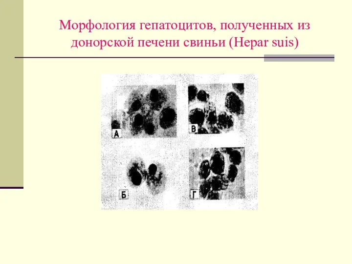 Морфология гепатоцитов, полученных из донорской печени свиньи (Hepar suis)
