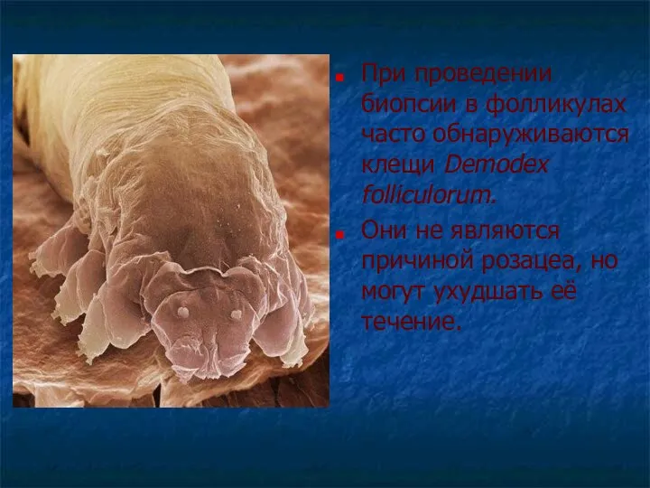 При проведении биопсии в фолликулах часто обнаруживаются клещи Demodex folliculorum. Они