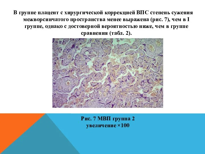 В группе плацент с хирургической коррекцией ВПС степень сужения межворсинчатого пространства