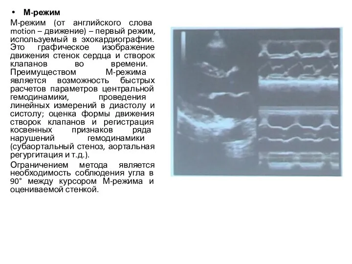 М-режим М-режим (от английского слова motion – движение) – первый режим,