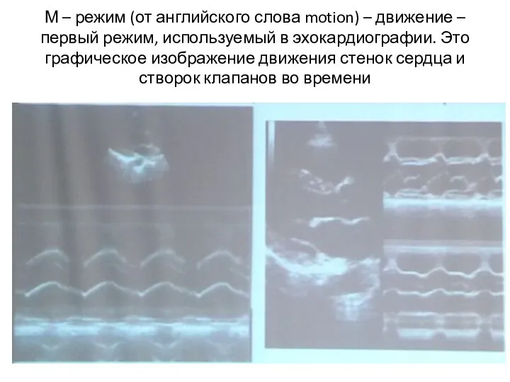 М – режим (от английского слова motion) – движение – первый