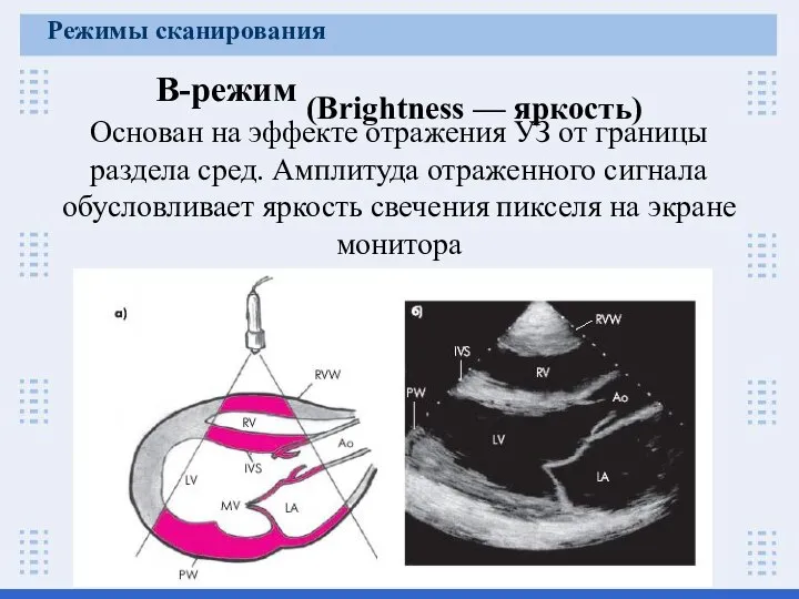 В-режим (Brightness — яркость) Основан на эффекте отражения УЗ от границы