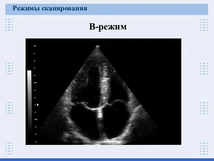 В-режим Режимы сканирования