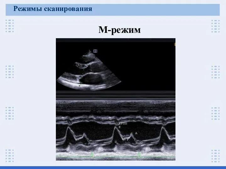 Режимы сканирования М-режим