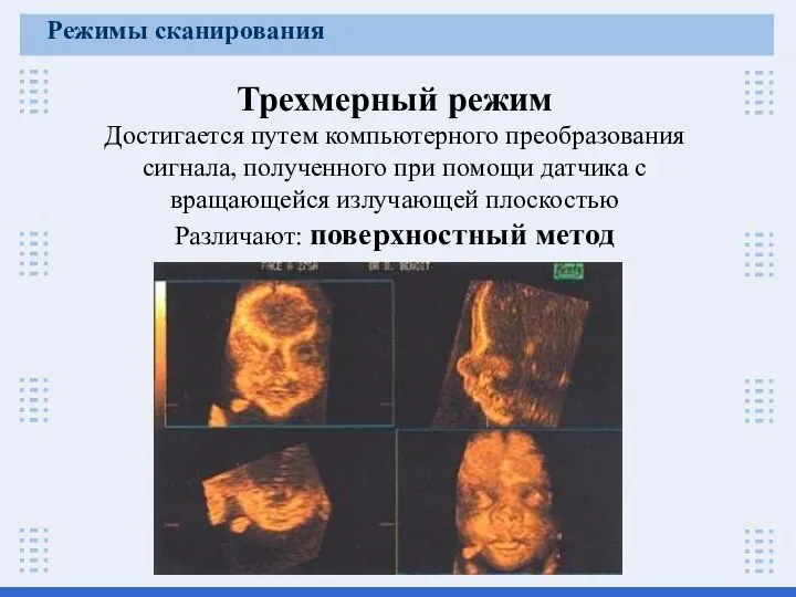 Трехмерный режим Достигается путем компьютерного преобразования сигнала, полученного при помощи датчика