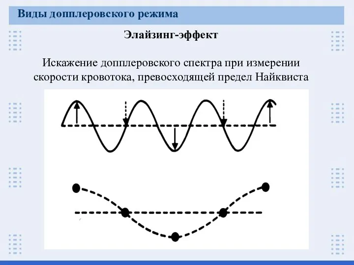 Элайзинг-эффект Искажение допплеровского спектра при измерении скорости кровотока, превосходящей предел Найквиста Виды допплеровского режима