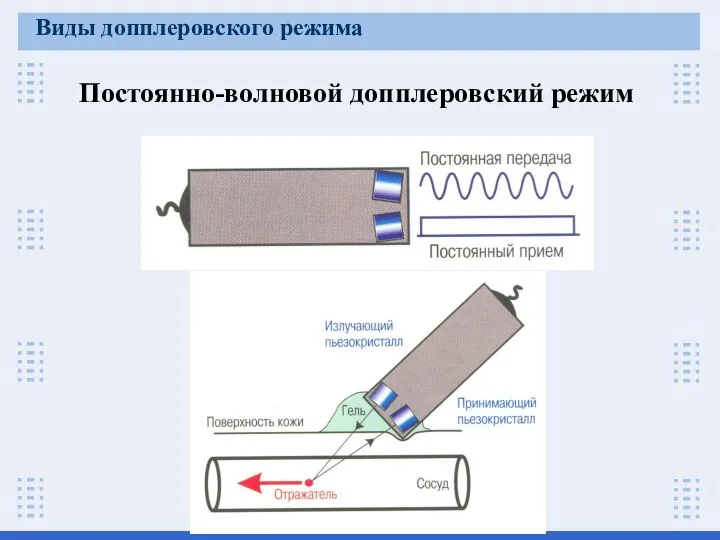 Постоянно-волновой допплеровский режим Виды допплеровского режима