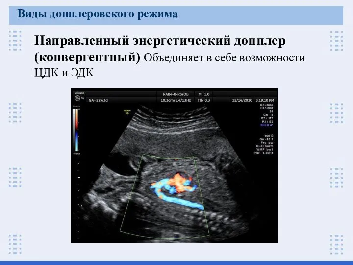 Направленный энергетический допплер (конвергентный) Объединяет в себе возможности ЦДК и ЭДК Виды допплеровского режима