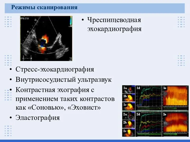 Режимы сканирования Стресс-эхокардиография Внутрисосудистый ультразвук Контрастная эхография с применением таких контрастов