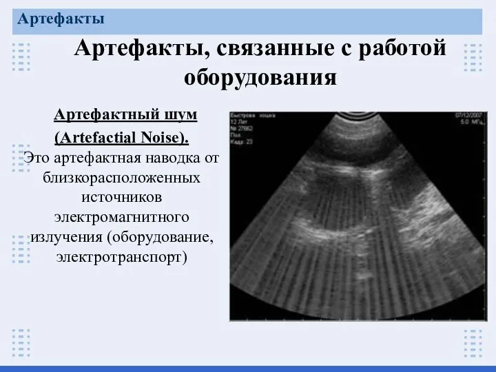 Артефакты, связанные с работой оборудования Артефакты Артефактный шум (Artefactial Noise). Это