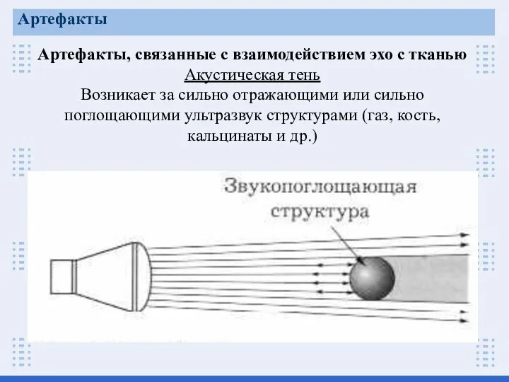 Артефакты, связанные с взаимодействием эхо с тканью Акустическая тень Возникает за