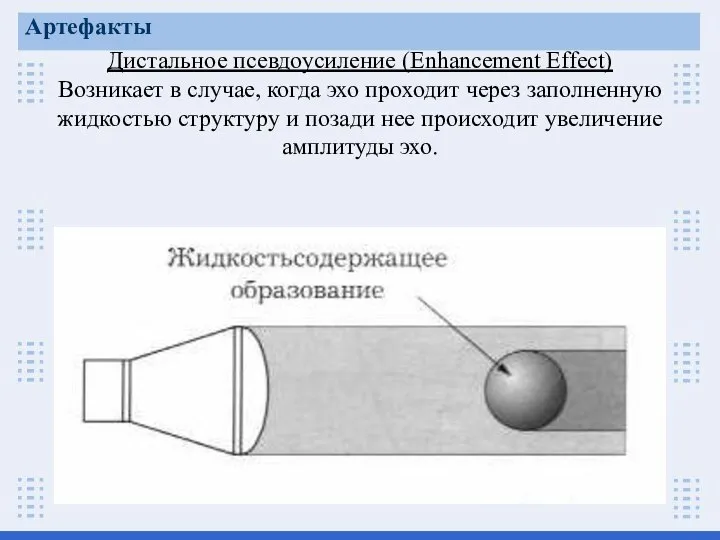 Дистальное псевдоусиление (Enhancement Effect) Возникает в случае, когда эхо проходит через