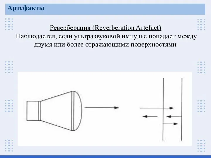 Реверберация (Reverberation Artefact) Наблюдается, если ультразвуковой импульс попадает между двумя или более отражающими поверхностями Артефакты