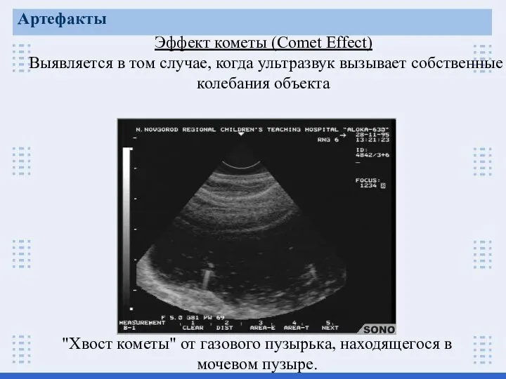 Эффект кометы (Comet Effect) Выявляется в том случае, когда ультразвук вызывает собственные колебания объекта Артефакты