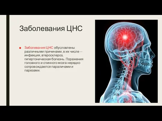 Заболевания ЦНС Заболевания ЦНС обусловлены различными причинами, в их числе --