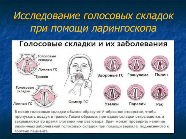 Исследование голосовых складок при помощи ларингоскопа