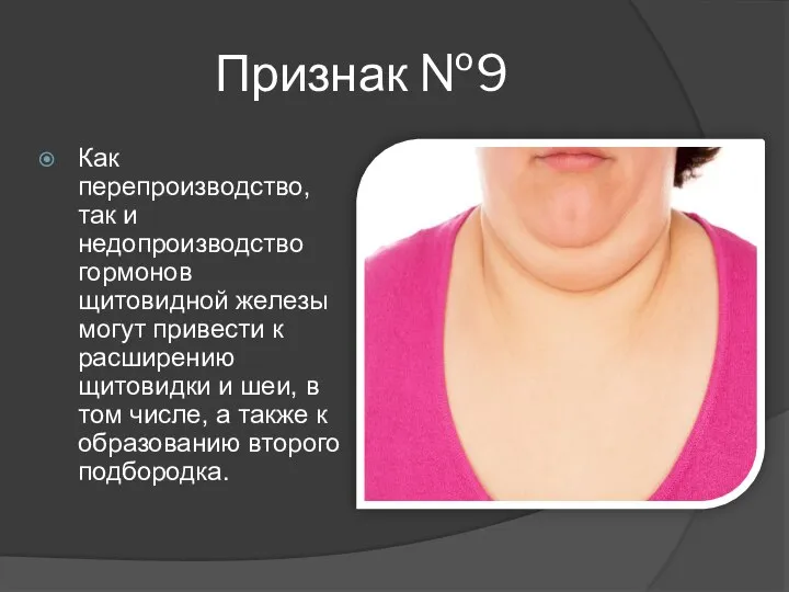 Признак №9 Как перепроизводство, так и недопроизводство гормонов щитовидной железы могут