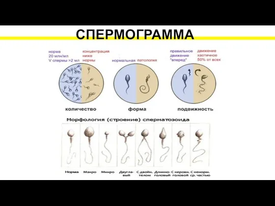 СПЕРМОГРАММА