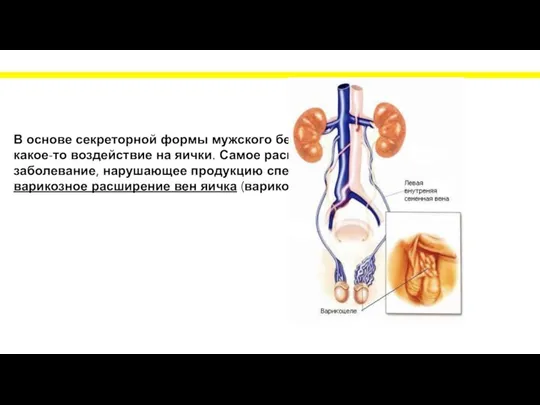 В основе секреторной формы мужского бесплодия всегда лежит какое-то воздействие на