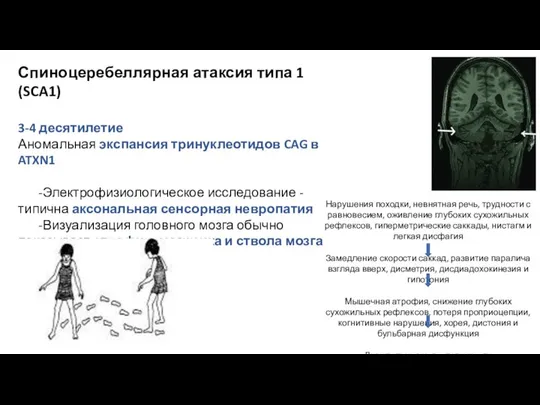 Спиноцеребеллярная атаксия типа 1 (SCA1) 3-4 десятилетие Аномальная экспансия тринуклеотидов CAG