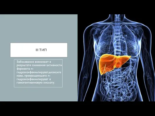 III ТИП Заболевание возникает в результате снижения активности фермента п-гидроксифенилпируватдиоксигеназы, превращающего п-гидроксифенилпируват в гомогентизиновую кислоту.