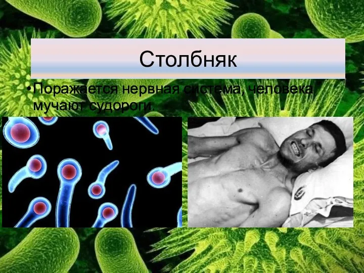 Столбняк Поражается нервная система, человека мучают судороги.