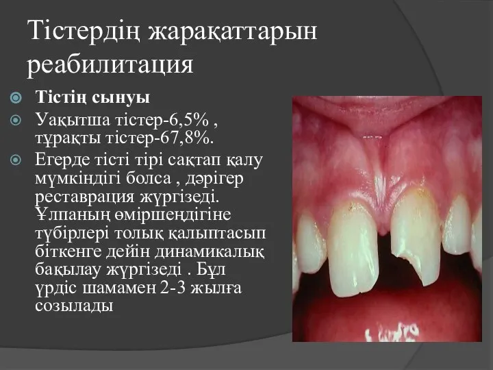 Тістердің жарақаттарын реабилитация Тістің сынуы Уақытша тістер-6,5% , тұрақты тістер-67,8%. Егерде