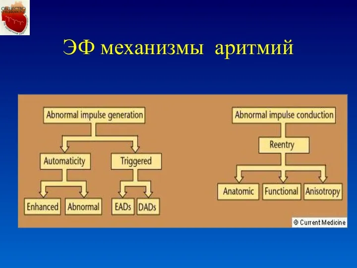 ЭФ механизмы аритмий