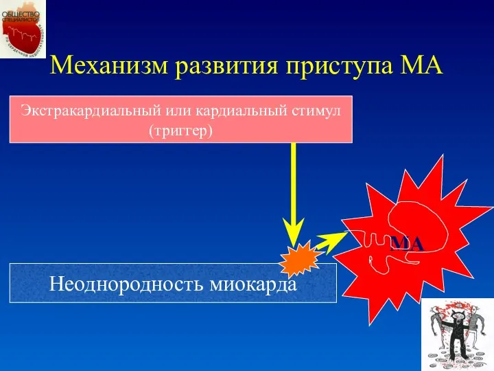 Механизм развития приступа МА Неоднородность миокарда Экстракардиальный или кардиальный стимул (триггер) МА