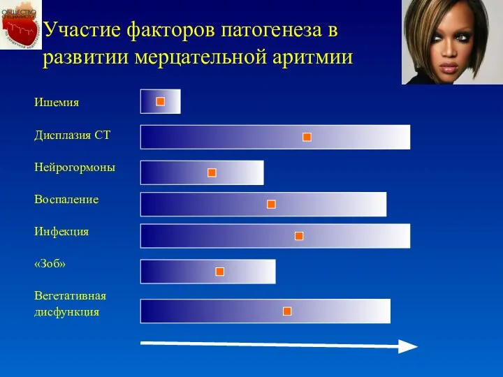 Участие факторов патогенеза в развитии мерцательной аритмии Ишемия Дисплазия СТ Нейрогормоны Воспаление Инфекция «Зоб» Вегетативная дисфункция