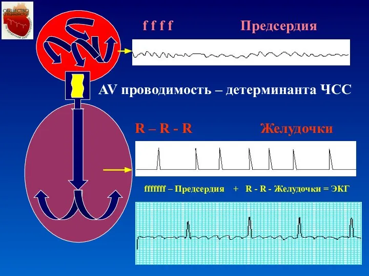R – R - R Желудочки AV проводимость – детерминанта ЧСС