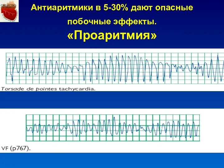 Антиаритмики в 5-30% дают опасные побочные эффекты. «Проаритмия»