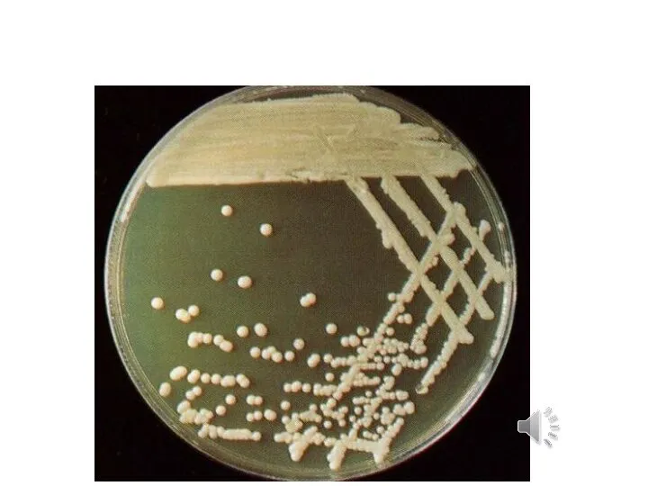 КОЛОНИИ МИКРООРГАНИЗМОВ