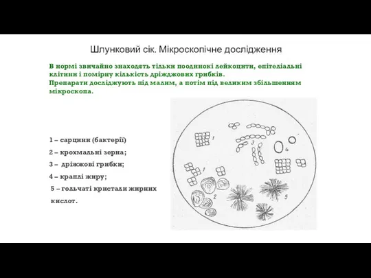 Шлунковий сік. Мікроскопічне дослідження В нормі звичайно знаходять тільки поодинокі лейкоцити,