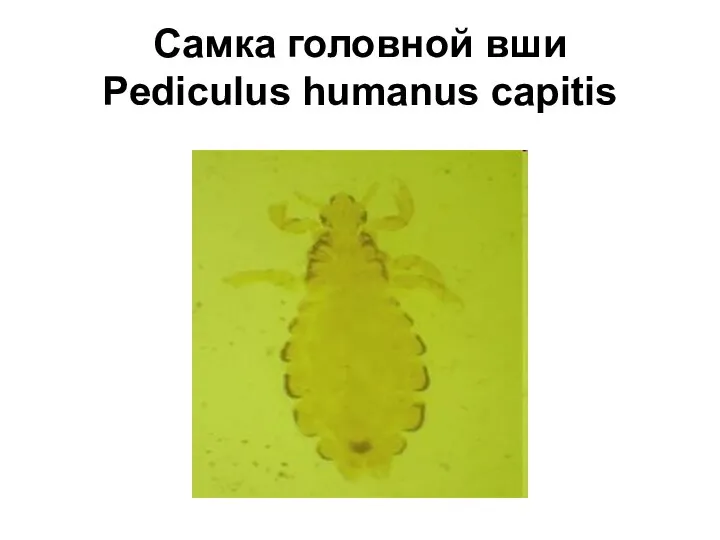 Самка головной вши Pediculus humanus capitis