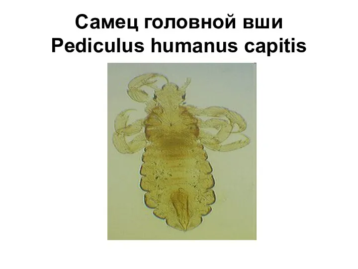 Самец головной вши Pediculus humanus capitis