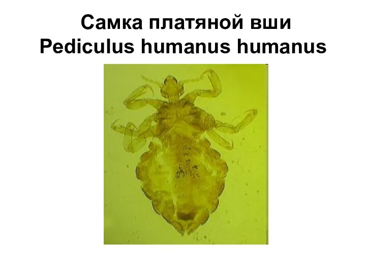 Самка платяной вши Pediculus humanus humanus