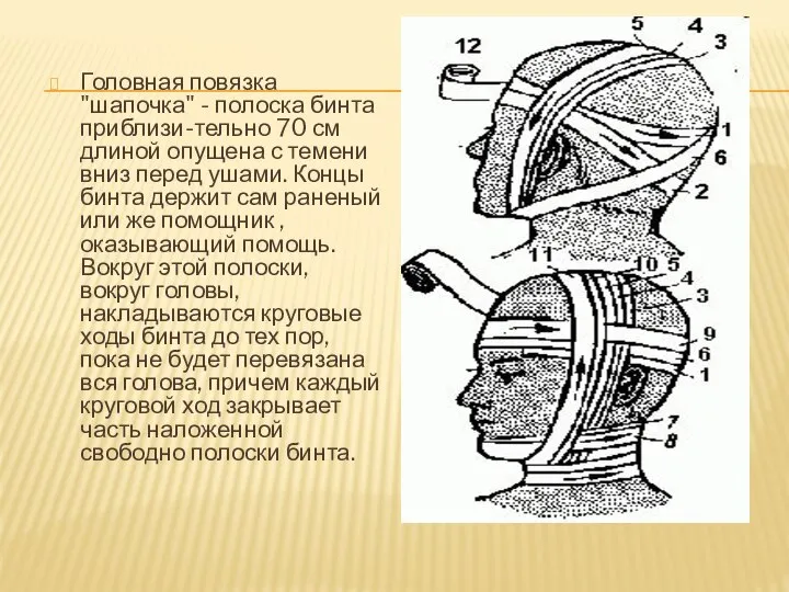 Головная повязка "шапочка" - полоска бинта приблизи-тельно 70 см длиной опущена