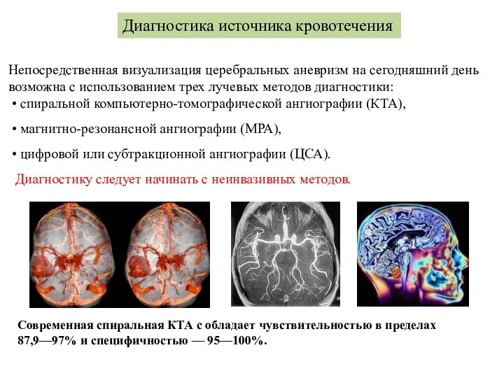 Диагностика источника кровотечения Непосредственная визуализация церебральных аневризм на сегодняшний день возможна