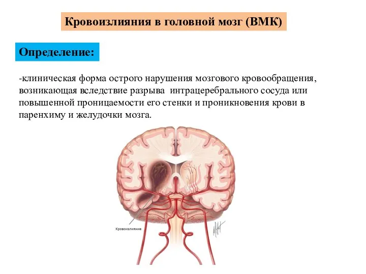 Кровоизлияния в головной мозг (ВМК) Определение: -клиническая форма острого нарушения мозгового