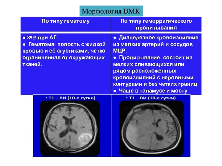 Морфология ВМК