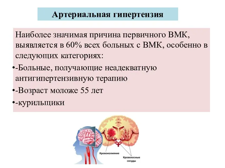 Артериальная гипертензия Наиболее значимая причина первичного ВМК, выявляется в 60% всех